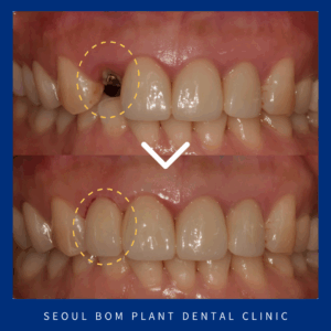 방이동치과추천14