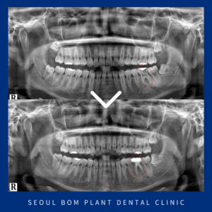 방이역치과잘하는곳11