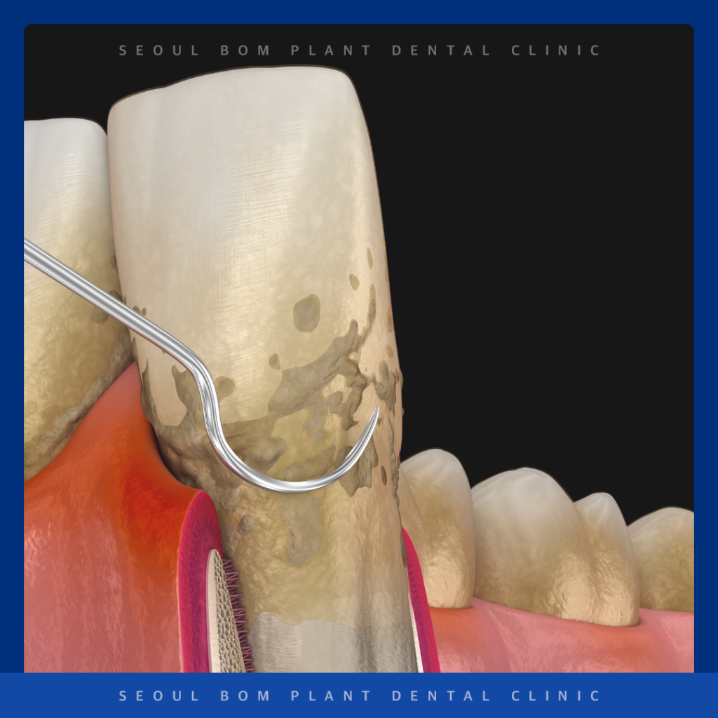 송파구 치주과 전문의