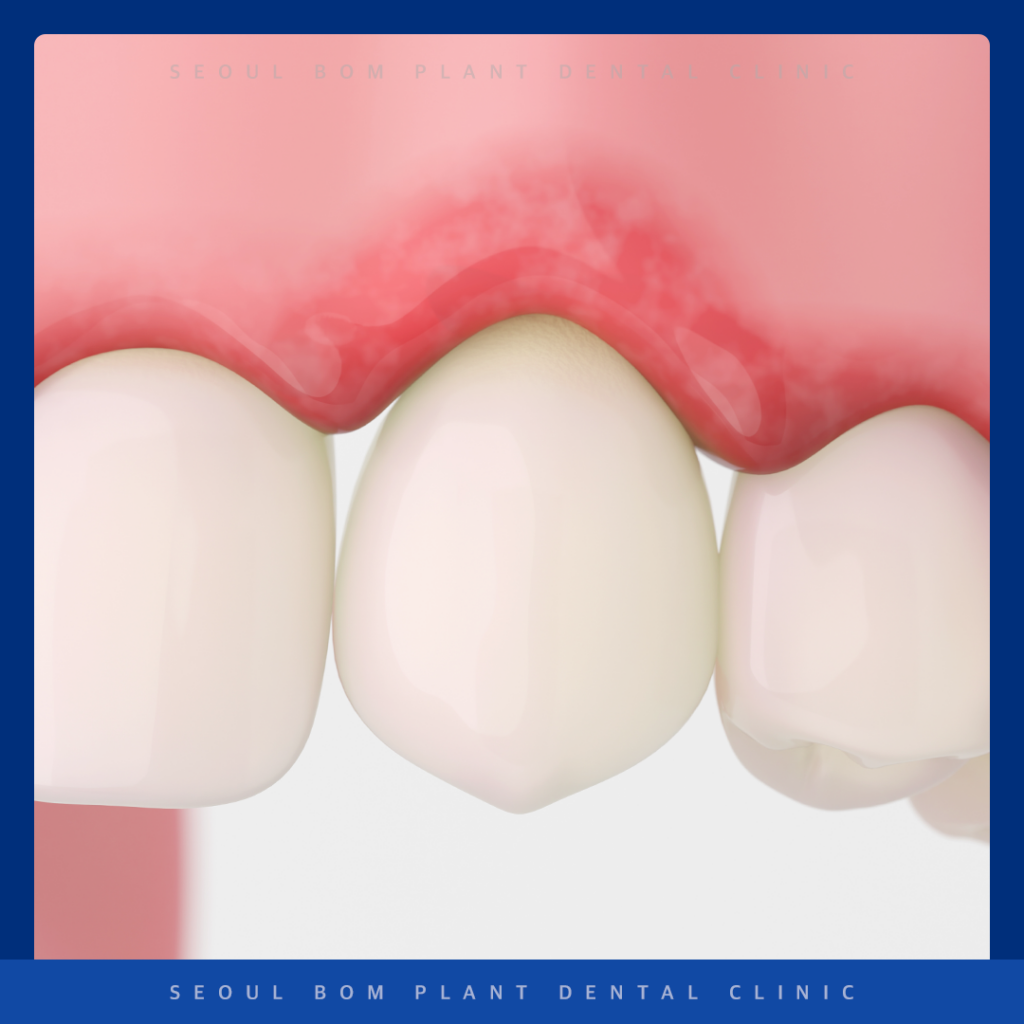 송파구 치주과 전문의